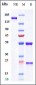 Anti-GD2 Reference Antibody (naxitamab)